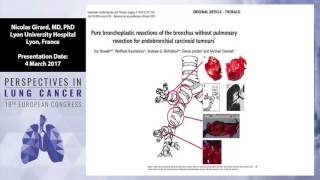 Carcinoids large cell neuroendocrine carcinoma thymoma and thymic carcinomas [upl. by Leah]