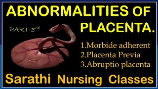 ABNORMALITIES OF PLACENTA  ABNORMAL PLACENTA  PLACENTA DISORDER  BY Balwant Nagar Amli sarathi [upl. by Kaela]