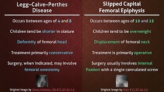 Legg–Calve–Perthes Disease vs Slipped Capital Femoral Epiphysis [upl. by Blaise730]