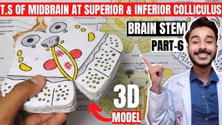 transverse section of midbrain at level of superior colliculus and inferior colliculus [upl. by Ludlew]