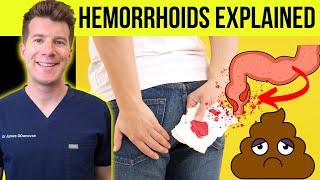 Doctor explains HEMORRHOIDS aka piles  Causes symptoms treatment amp prevention [upl. by Jaynes574]