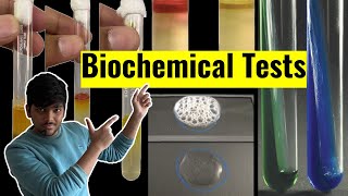 Biochemical Tests  Spotters and VIVA  Microbiology Practical  MBBS  IOM [upl. by Aig]