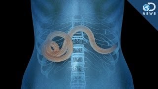 Why Parasites May Not Be All That Bad [upl. by Solana822]