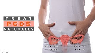 Treat PCOS Naturally  Nutritionist Guide [upl. by Anaili]