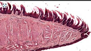 Histology of tongue filiform and fungiform papillae [upl. by Leander569]