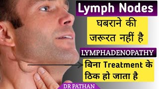 Lymph Nodes क्या है l Lymphadenopathy किसे कहते हैं l Lymphadenopathy कैसे ठीक करें l Lymph Nodes l [upl. by Nnaylime]