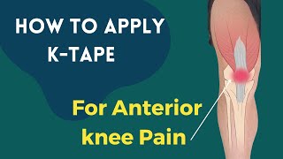 How to apply Kinesiology tape for knee pain  Patella Femoral Syndrome  Osgood Schlatters Syndrome [upl. by Milks]