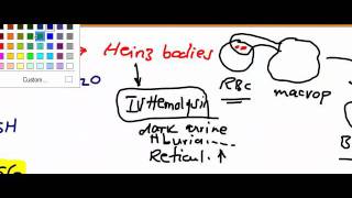 Usmle Step 1 Hematology 23 video [upl. by Nowahs]