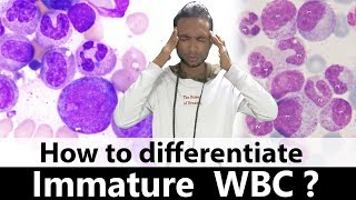 How to differentiate immature WBC [upl. by Nakeber289]