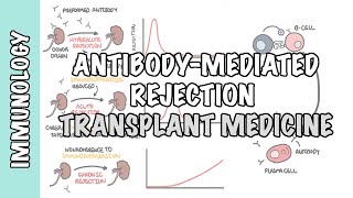 Transplant Medicine  Antibody mediated rejection [upl. by Llerryt]