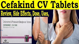 Cefakind cv 500 mg 250 mg Tablet uses in hindi  Review Cefakind tablets  cefuroxime tablets Uses [upl. by Lebasy]