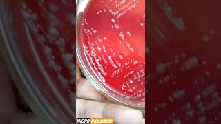 GRAM POSITIVE VS GRAM NEGATIVE BACTERIA GRAM POSITIVE VS GRAM NEGATIVE BACTERIA [upl. by Dickens]