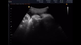 fetal ultrasound of 36 weeks37weeks baby boy moving [upl. by Hanikahs130]