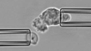 Chemotaxis and phagocytosis by a neutrophil encountering zymosan [upl. by Rossie]