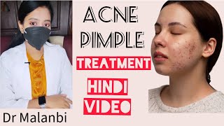 Acne Pimple treatment Cream  Epiduo gel 2•5  Doctors Review By DR MALANBI youtube acne [upl. by Wadsworth63]