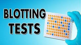 Blotting Techniques Western Blot Southern Blot and Northern Blot [upl. by Enidlarej735]