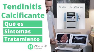 💪Tendinitis calcificante hombro tratamiento con fisioterapia ✅  10 años nos avalan Clínicas H3 [upl. by Atinehc]