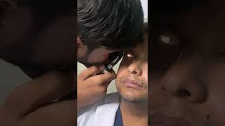 Fundoscopy with Khurram [upl. by Akirdna]