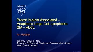 Breast Implant Associated  Anaplastic Large Cell Lymphoma by William J Casey III MD  Preview [upl. by Wollis]