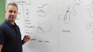 Abnormality of Sweat Glands in Cystic Fibrosis [upl. by Armallas]