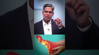 Nerve Pain amp Neuropathic Pain Causes Symptoms and Treatment [upl. by Ani]