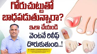 గోరుచుట్టు పోవాలంటే  How to Cure Paronychia  Nail Infection Treatment in Telugu  Healthy Bones [upl. by Brabazon]