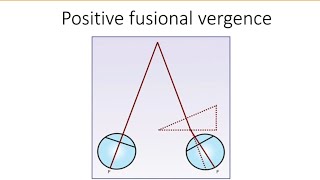 Orthopics series 5  Positive fusional vergence  PFV [upl. by Percy817]