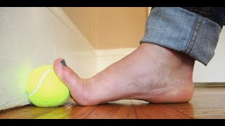 How I Cured My Bunions Naturally [upl. by Jorgensen]