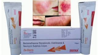 Ze Derm Cream Beclomethasone Dipropionate Clotrimazole amp Neomycin Sulphate Cream [upl. by Stanly]