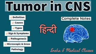 Tumor in CNS  Pathology  Hindi  Gross and Microscopic Pathology  Pathogenesis [upl. by Annailuj]