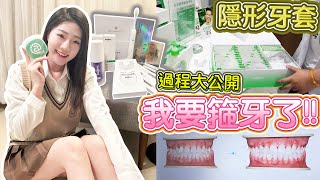 我要去箍牙！Beame 隱形牙套過程大公開 🦷｜美白牙齒 清潔套裝開箱｜矯正牙齒【Ceci Szee】 [upl. by Armelda]