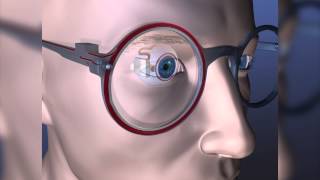 Artificial Retina Could Help Clear Your Vision [upl. by Walther468]