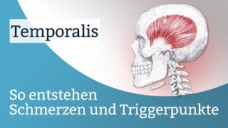 Temporalis Schmerzen Triggerpunkte und deren Aktivierung [upl. by Barret302]