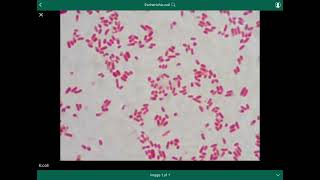 escherichia coli  الإشريكية القولونية [upl. by Yelnoc786]