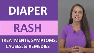 Diaper Rash Treatment Causes Symptoms Cream Ointment Home Remedies  Pediatric Nursing [upl. by Gibbon]