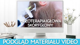 Sposób na łysienie MEZOTERAPIA IGŁOWA skóry głowy [upl. by Ecyak408]