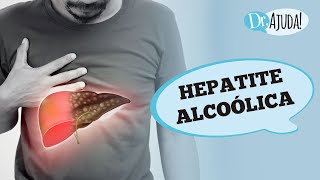 HEPATITE ALCOÓLICA E CIRROSE SINTOMAS DIAGNÓSTICO E TRATAMENTO [upl. by Salema]