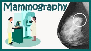 Mammography Test  Mammogram for breast cancer  What to expect  How to identify breast cancer [upl. by Nortad]