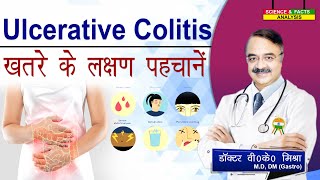 ULCERATIVE COLITIS ख़तरे के लक्षण पहचानें  ASK THE EXPERT HOW SERIOUS IS ULCERATIVE COLITIS [upl. by Neelie]