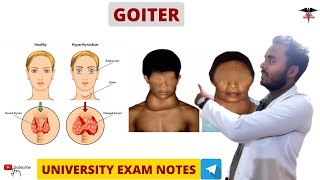 Goitre  Hypothyroidism amp Hyperthyroidism  Endocrine Physiology [upl. by Auliffe]