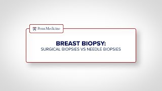 Breast Biopsy Surgical Biopsy vs Needle Biopsy [upl. by Adrian]