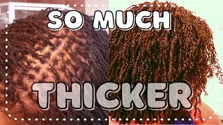 Sisterlocks on Fine Thin hair  5month Sisterlocks Journey update [upl. by Eusoj687]