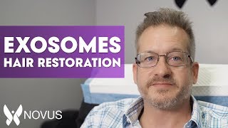 How Do Exosomes For Hair Restoration Work  Full Hair Treatment Explanation  Novus [upl. by Alroi724]