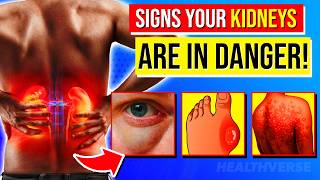 10 ALARMING Early Signs Your Kidneys Are In DANGER [upl. by Lawler]