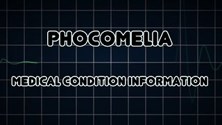 Phocomelia Medical Condition [upl. by Euqcaj576]