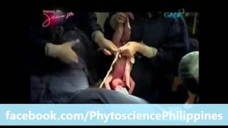 Kapuso Mo Jessica Soho Stem Cell Technology [upl. by Roath]