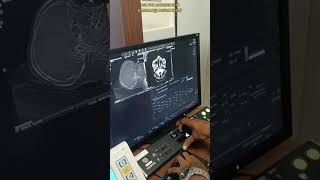 Radiology DepartmentCT Scanbscnursing hospital doctor viralvideo shortvideossong youtuber [upl. by Anael]