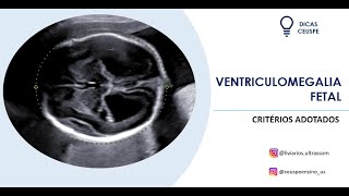 Ventriculomegalia fetal como avaliar [upl. by Holder]