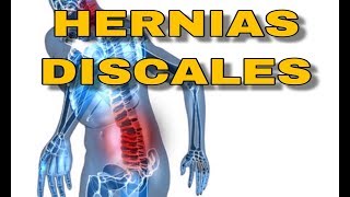 COMO MEJORAR SIN CIRUGIA  hernias discales sintomas recuperacion estiramientos hernia discal [upl. by Eamanna63]