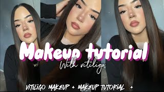 Makeup tutorial  with vitiligo 🤍 [upl. by Rianna175]